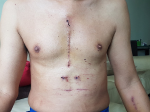 The scars look more nasty in photos than they actually are