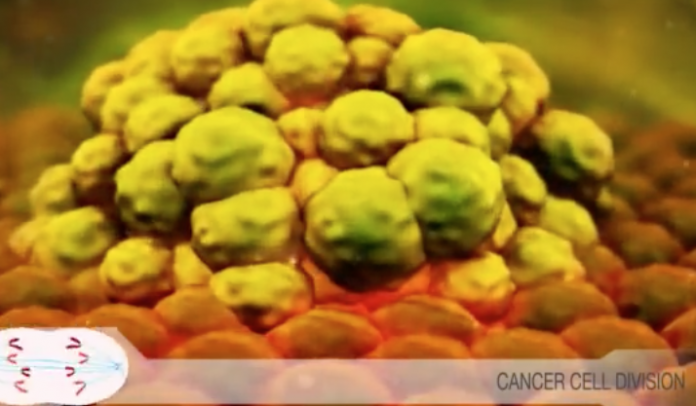 CANCER