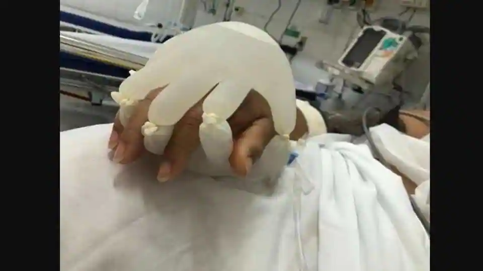 nurses-in-brazil-use-gloves-to-simulate-‘human-contact’-for-covid-patient,-pic-is-viral