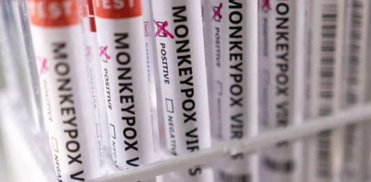 how-to-lower-risk-of-transmission-of-monkeypox-during-sex-–-according-to-us-cdc