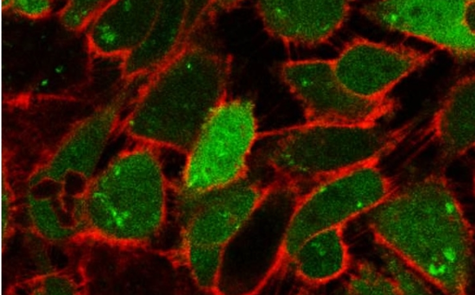 NUS scientists uncover potential cause of breast cancer relapse