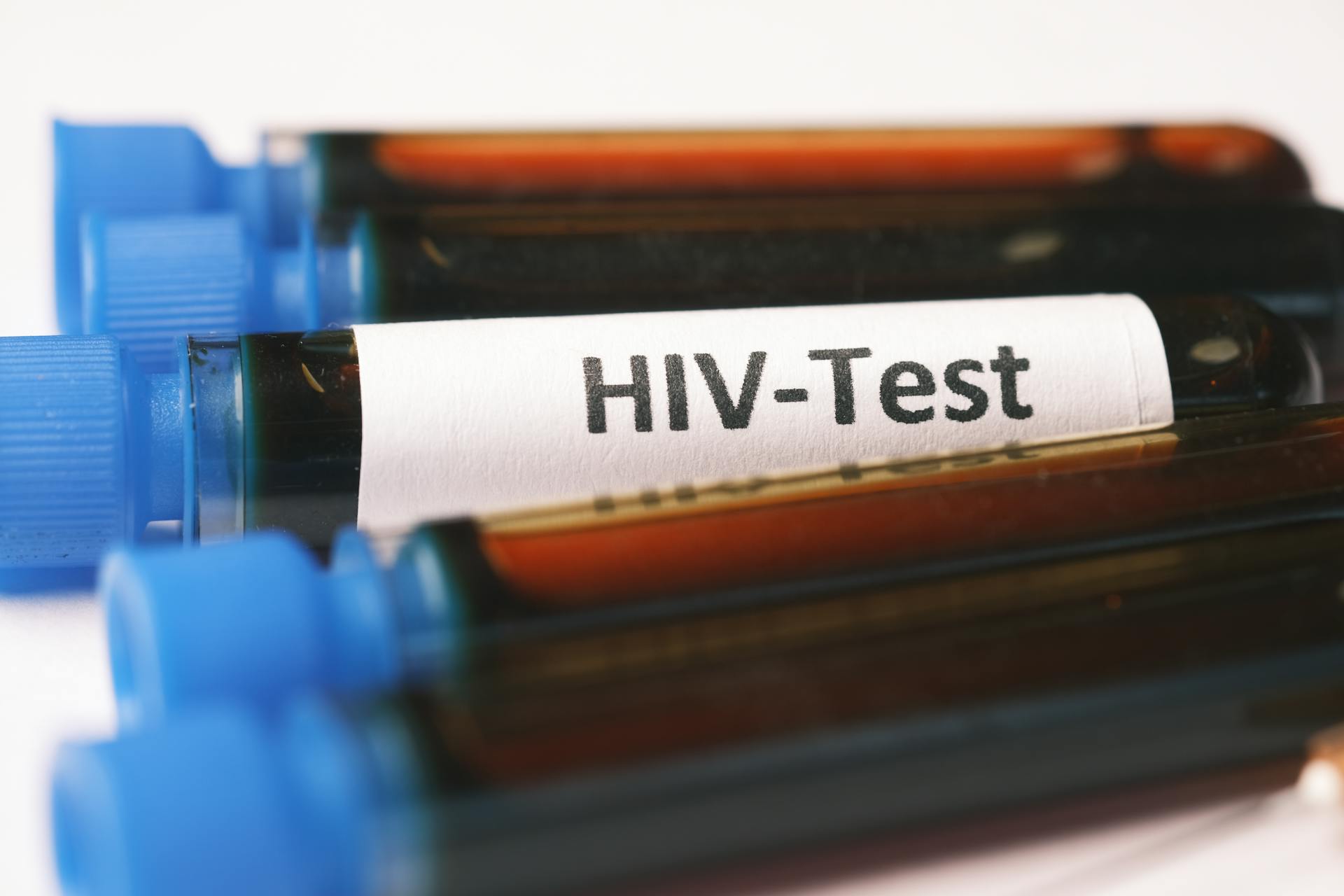 HIV self-testing kits to be available at pharmacies from next month